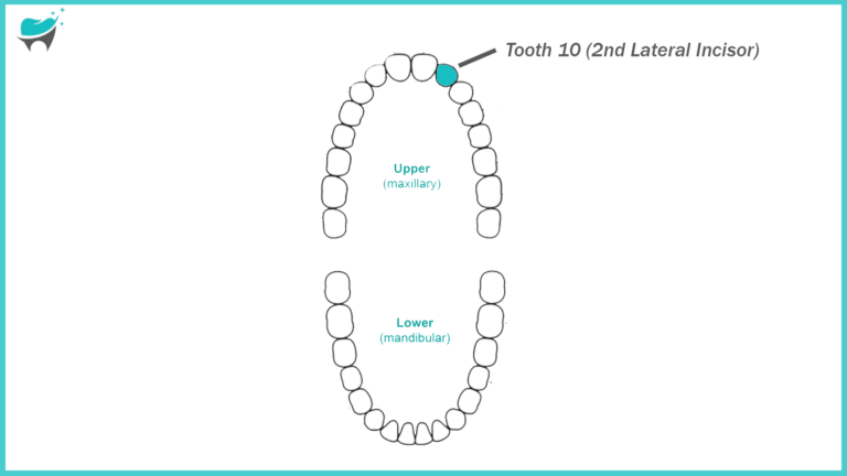 The Upper Left Lateral Incisor Tooth 10: Location, Function, and Care