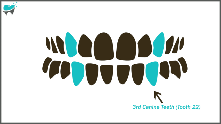 Tooth 22: The Lower Left Canine Whitening Guide