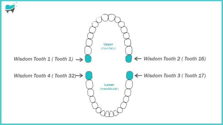 Wisdom Teeth: Location, Pain, and Extraction for (1, 16, 17, 32)