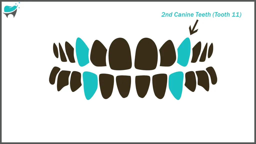 tooth 11 (2nd canine)