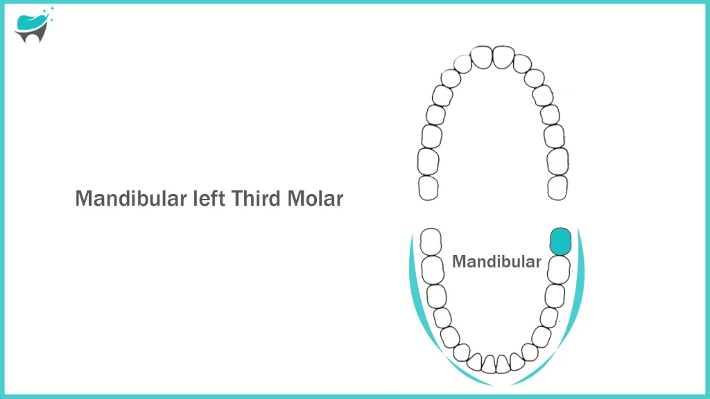 mandibular teeth 17