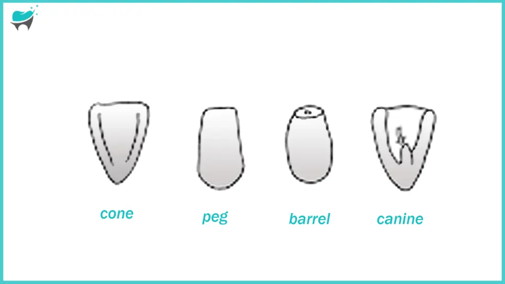 lateral incisors tooth types