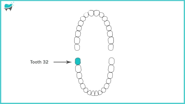 Tooth 32: Understanding Mandibular Third Molar: “Location, and Pregnancy-Related Pain”