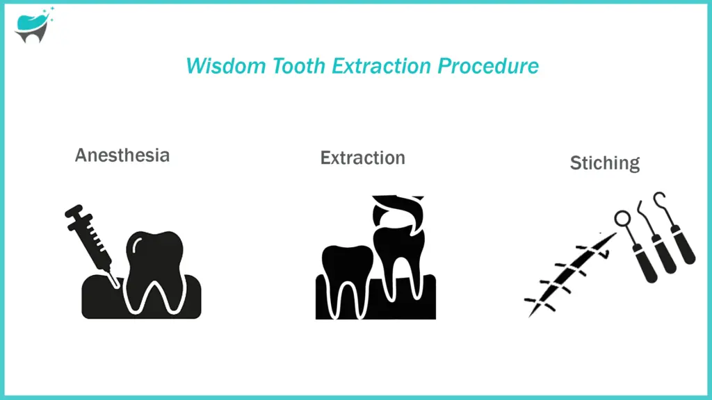 wisdom tooth extraction procedure
